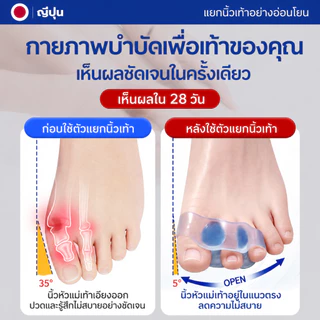 ซิลิโคนแยกนิ้วเท้า ช่วยจัดเรียงนิ้วเท้า ลดการเบียด ลดการเสียดสี ใส่สบาย ใช้ซ้ำได้