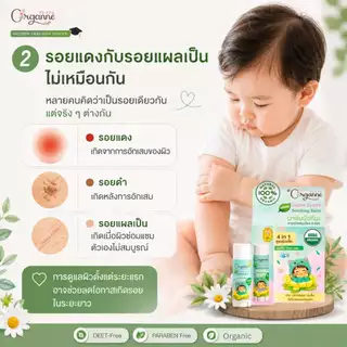 🌷Organne AB-003 บาล์มบัวหิมะ ออร์แกนิค