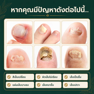 Kreain Natureน้ำยาบำรุงเล็บ บรรเทาผลกระทบจากเล็บติดเชื้อเล็บโค้งงอและเน่าเสีย และกำจัดเชื้อราได้