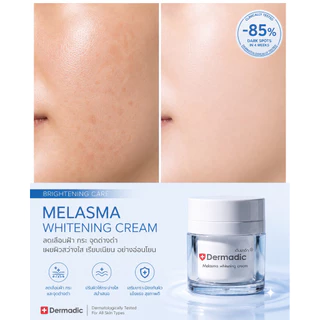 เดิมมาดิก DERMADIC F50 เมลาสม่า ไวท์เทนนิ่ง ครีม 50 g. บำรุงผิวหน้าขาว ลด ฝ้า กระ รอยดำ สูตรสีฟ้า