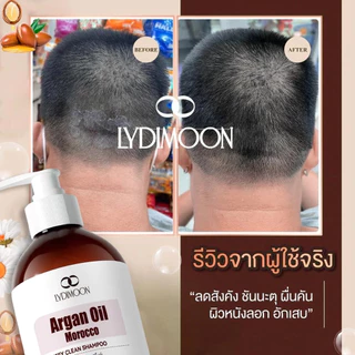 แชมพูสระผมสะอาด แชมพูแก้คัน นี้ช่วยขจั ดรังแค กำจัดเชื้อรา สะเก็ดเงิน ลอก พร้อมซ่อมแซมปลายผมแตก และทำให้ผมเรียบลื่น500ml