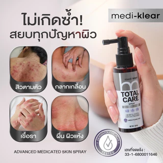 (เมดิเคลียร์) Medi-Klear สเปรย์สิวหลัง ขนคุด ผื่นคัน ผิวเชื้อรา Total Care Spray