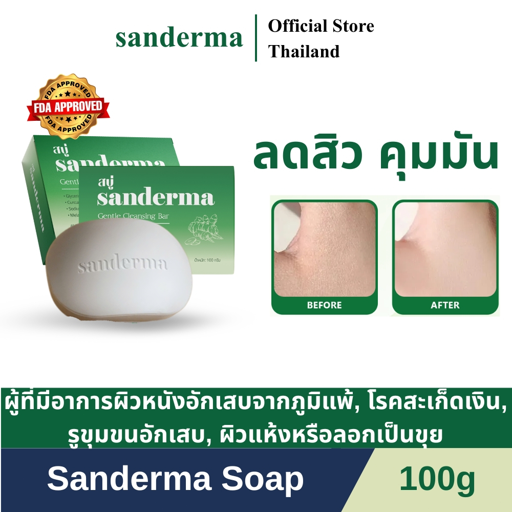 สบู่สมุนไพร Sanderma สูตรใหม่ 100 กรัม สูตรสมุนไพร ช่วยลดอาการคัน ลดสิวที่หลัง เหมาะสำหรับผิวแห้งและผิวแพ้ง่าย
