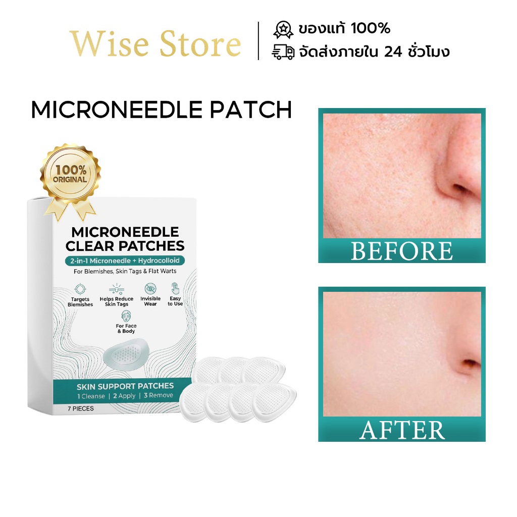 Microneedle Patch ไมโครนีดเดิล แผ่นแปะสิว แผ่นแปะ สำหรับ ลดริ้วรอย กระชับ คืนความไบร์ท สูตรอ่อนโยน ปลอดภัย