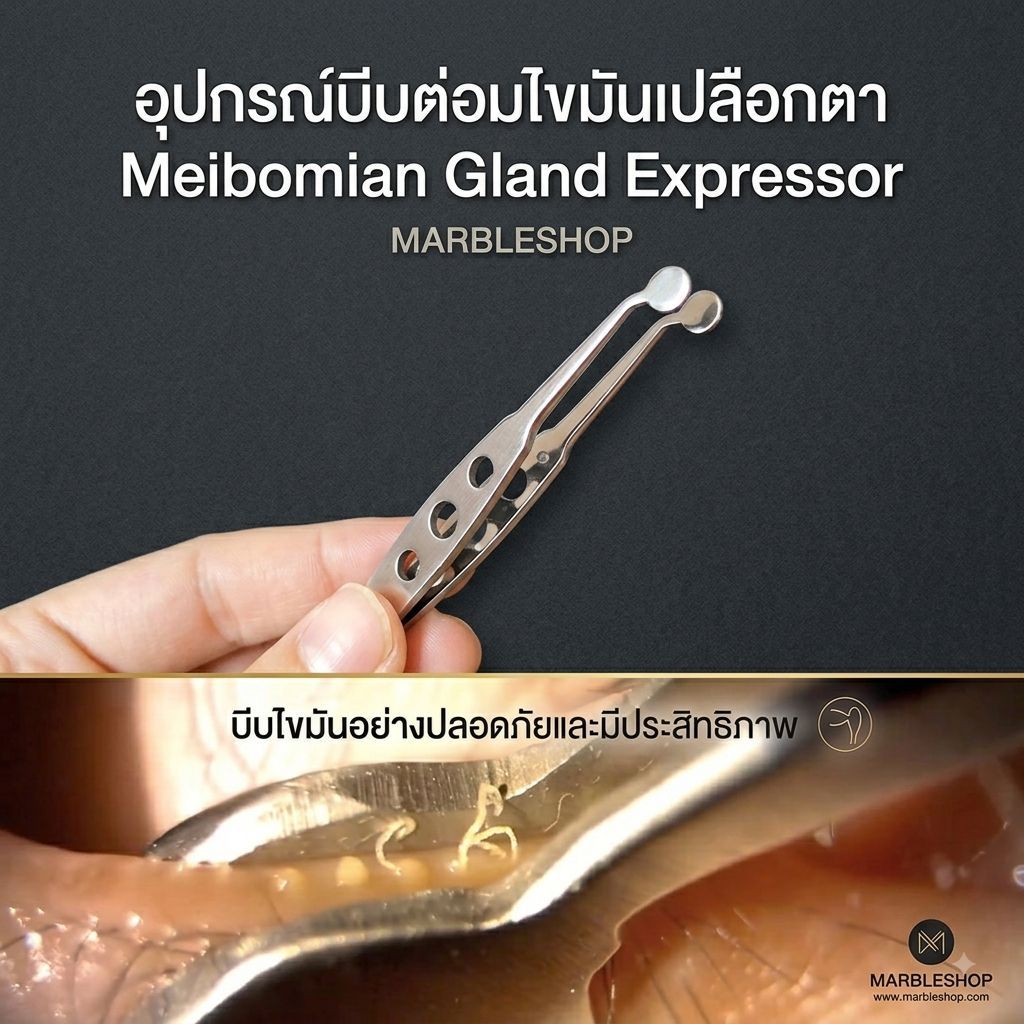 (ส่งจากไทย) คีมบีบต่อมไขมันเปลือกตา แหนบ Meibomain Gland Forceps สแตนเลส แก้ตาแห้ง ต่อมไขมันอุดตัน