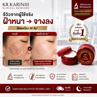 ครีมการิน ตลับแดง ทาฝ้า ริ้วรอย | KARIN111 Brightening Cream – ครีมคลินิก สูตรเข้มข้น ฝ้า กระ จุดด่างดำ ผิวดูกระจ่างใส