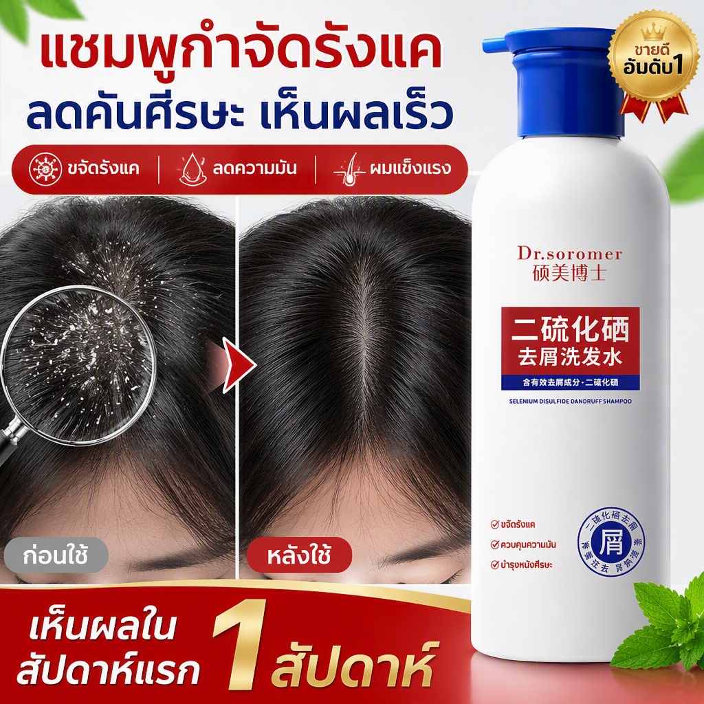 แชมพูขจัดรังแค ซีลีเนียมไดซัลไฟด์ 400ml กำจัดไรฝุ่น ควบคุมความมัน ผมนุ่มฟู