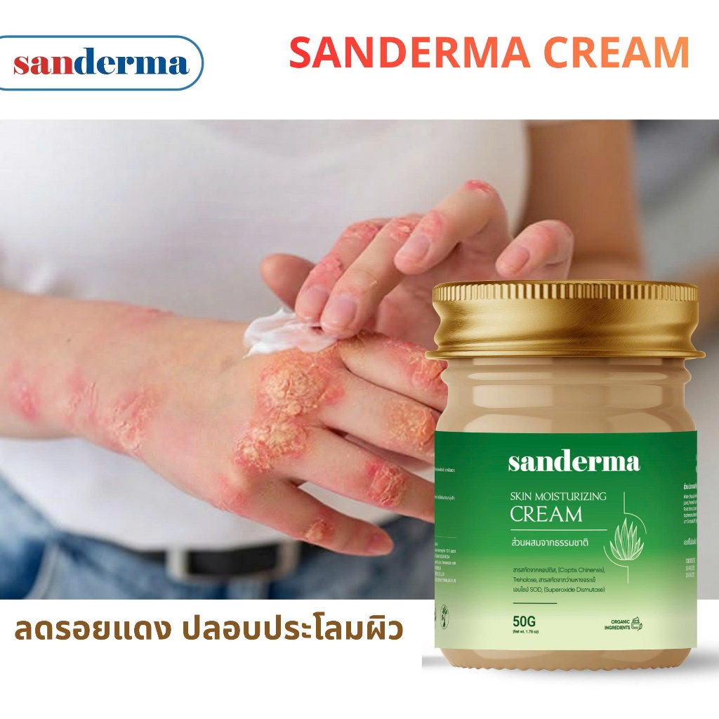 [SET 2] Sanderma ครีมบำรุงผิว สูตรอ่อนโยน เติมความชุ่มชื้น ลดอาการแสบแดง ผิวแพ้ง่ายใช้ได้ 50g x 2