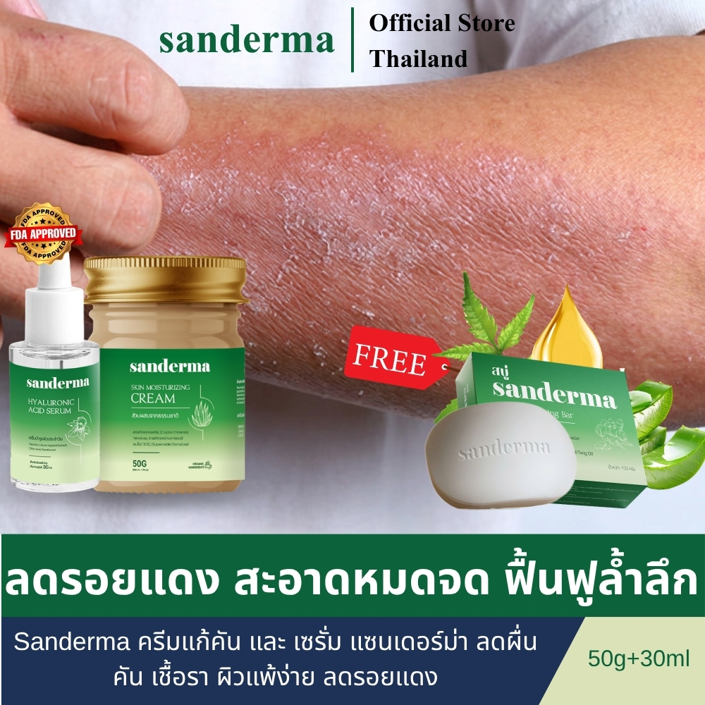 Sanderma ครีมแก้คัน และ เซรั่ม แซนเดอร์ม่า ลดผื่นคัน เชื้อรา ผิวแพ้ง่าย ลดรอยแดง