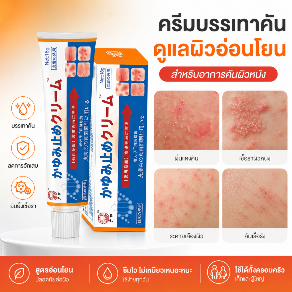 หยุดคันเร็ว✨ครีมป้องกันเชื้อรา ครีมแก้คัน ครีมสะเก็ดเงิน บรรเทาอาการคัน ที่มีประสิทธิภาพกับการติดเชื้อที่เชื้อรา กลาก ผื