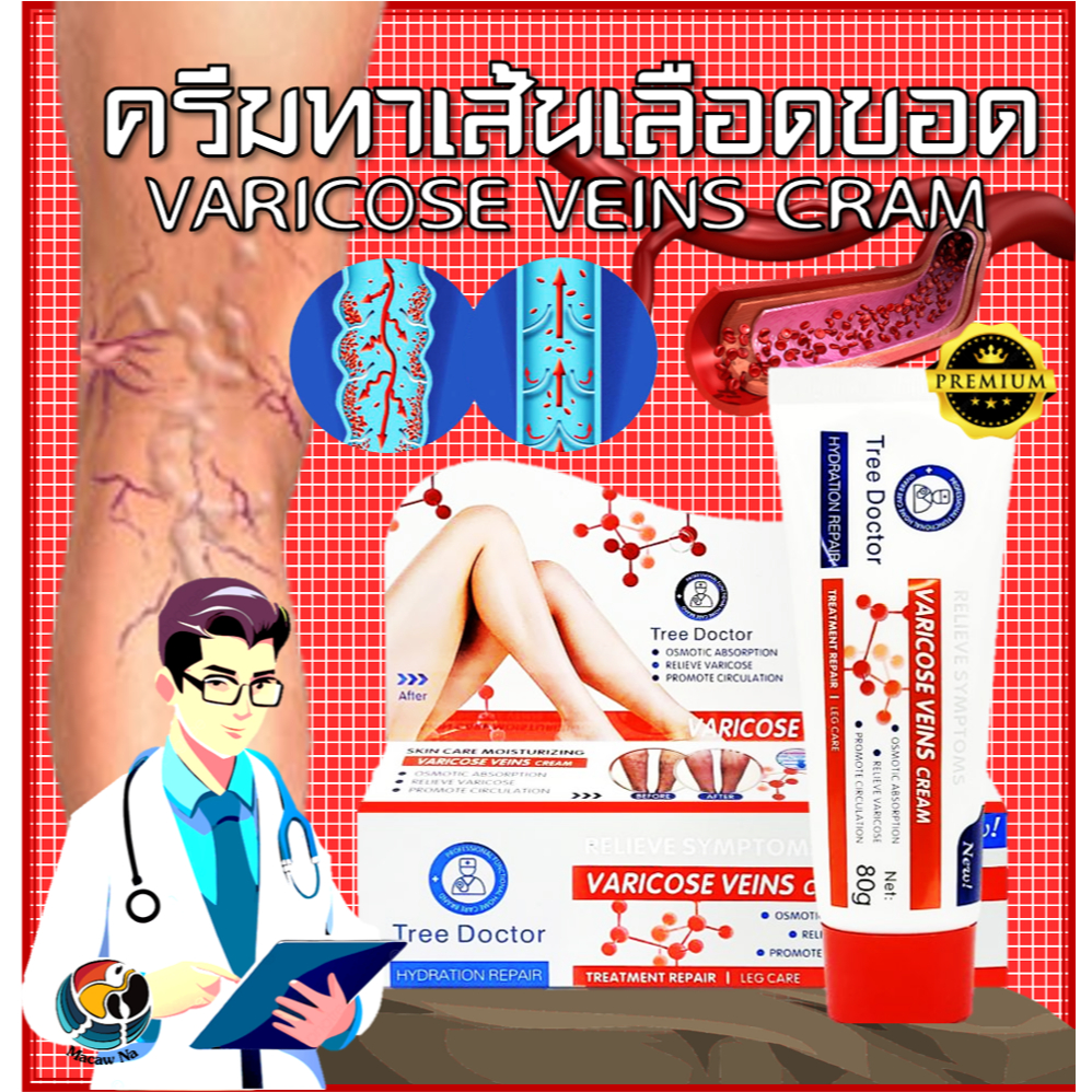 ครีมทาลดเส้นเลือดขอด Tree Doctor VARICOSE VEINS CREAM