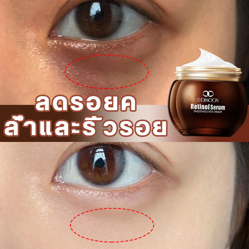 ครีมลดถุงใต้ตา อายครีมบำรุงตา ครีมบำรุงรอบดวงตา 35g ให้ความชุ่มชื้น เรตินอล ลดรอยคล้ําใต้ต จบริ้วรอยรอบดวงตาใน ยกกระชับ