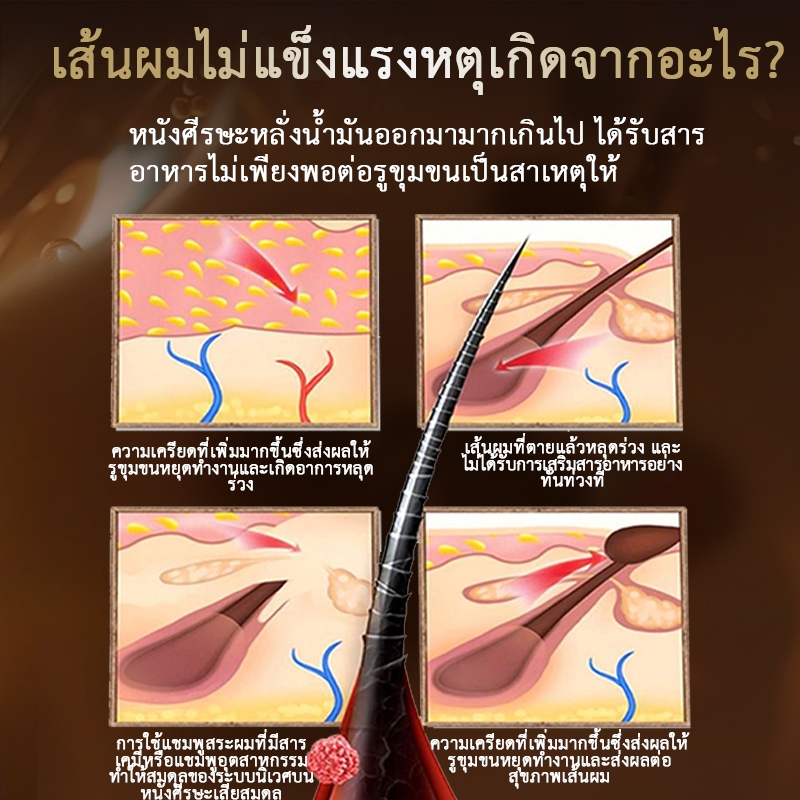 SAFEMILD แชมพูสมุนไพรโบราณ แก้ปัญหาผมร่วง ทำให้ผมขาวกลับมาดำ บำรุงผมด้วยส่วนผสมจากธรรมชาติ Y9-25 - รูปที่ 3