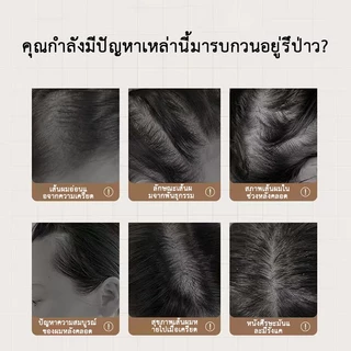 【ของแท้จากร้านออฟฟิเชียล】SAFEMILDแชมพูป้องกันผมร่วงช่วยบรรเทาอาการคันหนังศีรษะและลดปัญหาผมบางได้อย่างมีประสิทธิภาพ
