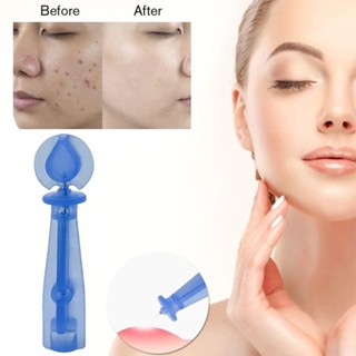 เข็มเจาะสิว เข็มเจาะปลายนิ้ว ปลอดเชื้อ บรรจุ 50 ชิ้น/กล่อง เ…