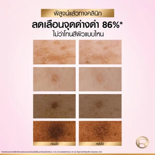 [ใช้โค้ดไลฟ์เหลือ 427.-] L'Oréal Paris Glycolic Bright Anti-Dark Spot Brightening Serum 30ml เซรั่มผิวโกลว์กระจ่างใส