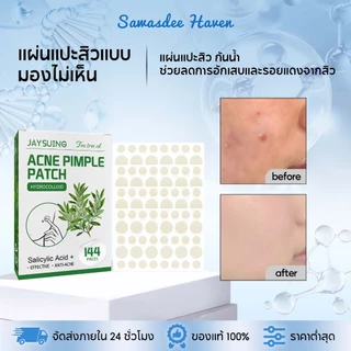 Jaysuing แผ่นแปะสิวน้ำมันทีทรี แผ่นแปะสิวแบบมองไม่เห็น แผ่นแปะสิวแบบไร้รอย แต่งหน้าได้ แปะสิวซ่อนรอย แผ่นแปะสิว กันน้ำ