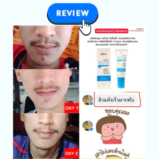 เจลแต้มสิว DERRATU 6g แต้มสิวยุบไว เร่งรอยสิวหาย สิวอักเสบ สิวอุดตัน สิวไตแข็ง สิวผด รอยสิว