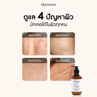 [พร้อมส่งทุกวัน] skinness brightening dark spot body lotion | ครีมลดรอยผิวกายฝาดำ