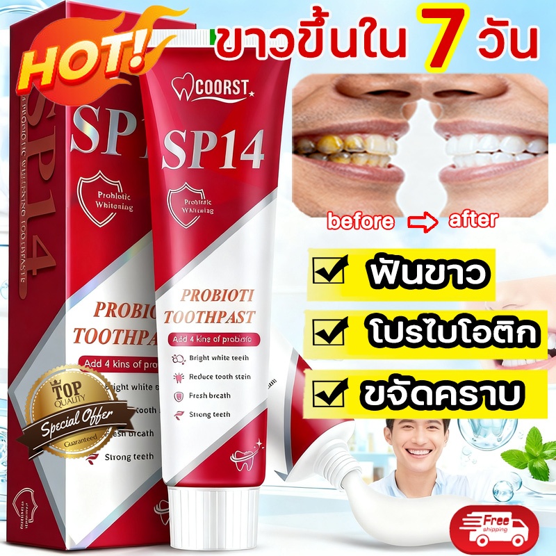 SP-14 ยาสีฟันไวท์เทนนิ่ง ยาสีฟันเบกกิ้งโซดา ขจัดคราบหินปูนสีเหลือง  ซ่อมแซมฟัน ขจัดกลิ่นปาก ป้องกันฟ