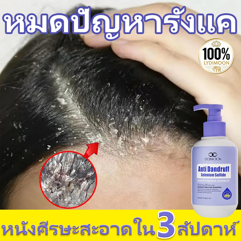 LYDIMOON แชมพูขจัดรังแค: ขจัดรังแคได้อย่างมีประสิทธิภาพ บรรเทาอาการคันหนังศีรษะ ลดความมัน และฟื้นฟูผ