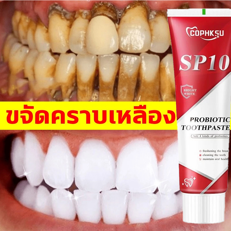 SP-10ยาสีฟัน ลดฟันเหลือง ฟันขาว ขจัดกลิ่นปาก ป้องกันฟัน ฟอกสีฟั โปรไบโอติกยาสีฟ
