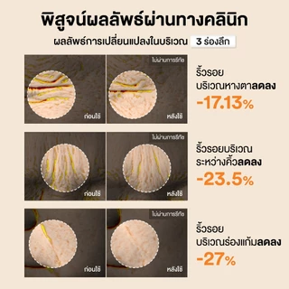 COSRX The Alpha-Arbutin Discoloration Care Hydrogel Mask ดิ อัลฟ่า-อาร์บูติน ดิสโคโลเรชั่น แคร์ ไฮโดรเจล มาส์ก