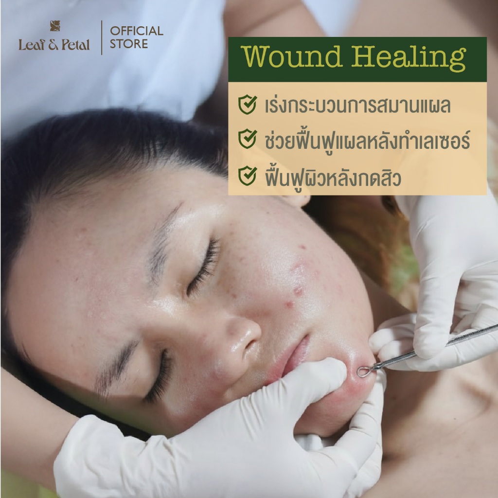 LEAF&PETAL SkinClear Facial Spray สเปรย์ฆ่าเชื้อสิวด้วยสารไฮโปรคลอรัส(HOCl) อ่อนโยน ไม่อุดตัน ไม่ดันสิว ลดการระคายเคือง รูปที่ 7