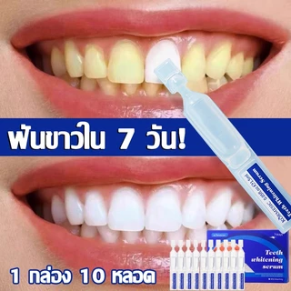 ฟอกฟันขาว ฟันขาว น้ำยาฟอกฟันขาว ที่ฟอกฟันขาว ยาฟอกฟันขาว น้ำยาขัดฟันขาวTeeth Whitening Pen ปากกาฟอกฟันขาว เจลฟอกฟันขาว