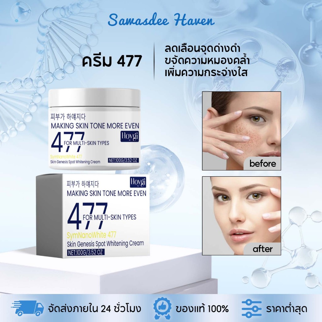 Hoygi ครีม 477 ลดเลือนจุดด่างดำ ฟื้นฟูผิวขาวกระจ่างใส มอยเจอร์ไรเซอร์ ครีมทาหน้า ครีมบำรุงผิว ลดการเ