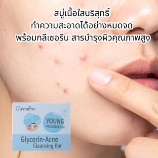สบู่ล้างหน้า, สบู่ล้างหน้ากิฟฟารีน, สบู่ลดสิว, สบู่มังคุด สบู่ผิวมัน, สบู่หัวไชเท้า,สบู่ข้าวหอมมะลิ