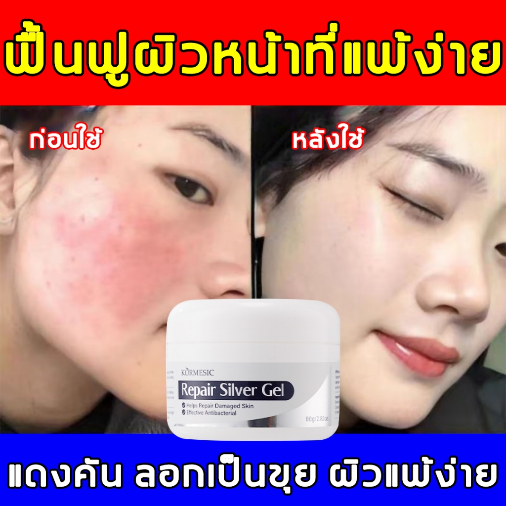 ครีมซ่อมแซมผิว 80g ครีมซ่อมแซมความชุ่มชื้น ซ่อมผิวเบิร์น5วิ สมานแผล สมานผิวอักเสบ ลดรอยแดง ครีมดูแล