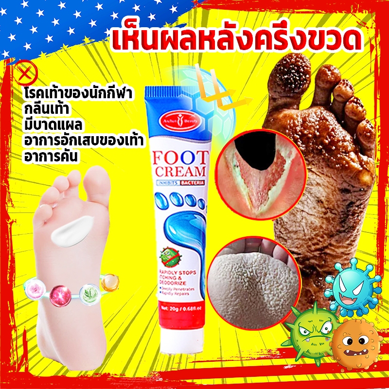 🔥ลดแรง🔥ครีมลดกลิ่นเท้า เท้าแห้งกร้าน สกิน ซอฟเทนเนอร์ISkin SoftenerIครีมทาเท้า สเปรย์ดับกลิ่นเท้า