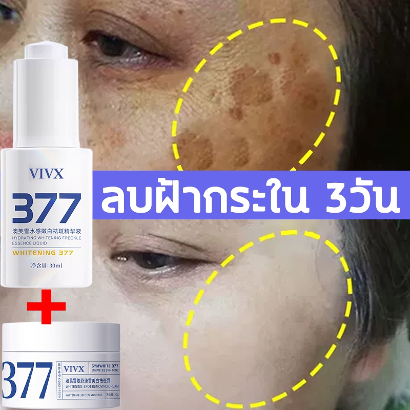 377ครีมแก้ฝ้าผิวขาว ลดริ้วรอยและจุดด่างดำ บำรุงผิวขาวกระจ่างใส มอยเจอร์ไรเซอร์  ครีมบำรุงผิว รอยสิวจ