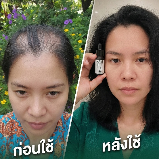 รูปภาพ 3