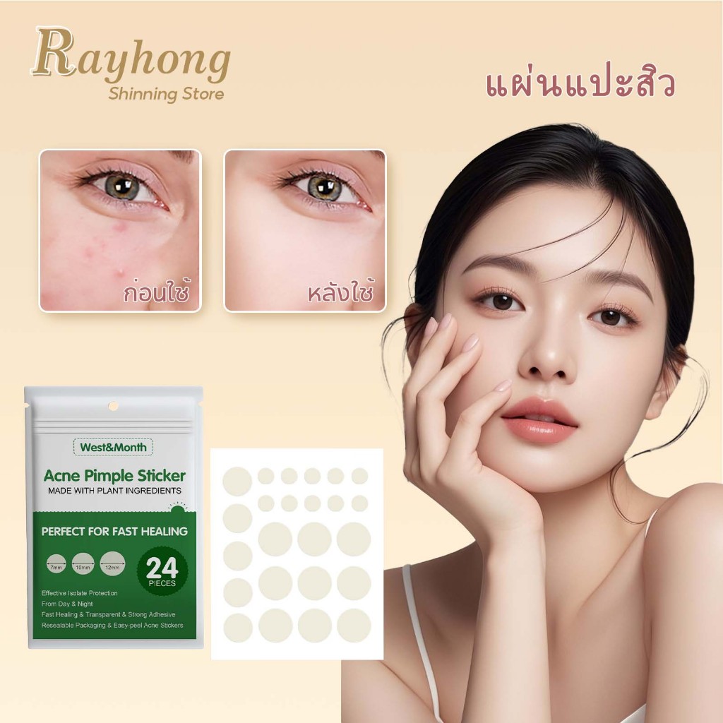 West&Month แผ่นแปะสิว ผิวหนังเทียมไฮโดรคอลลอยด์ กันน้ำและระบายอากาศได้ รูขุมขนหดตัว ลดรอยด่างดำ