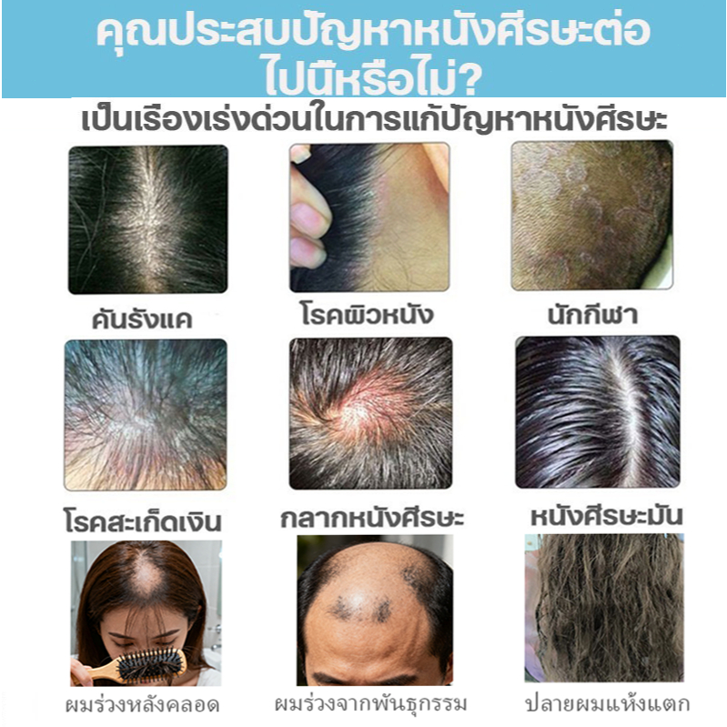 [แพ็คคู่] SAFEMILD แชมพูป้องกันผมร่วง ครีมนวดผม ส่งเสริมการเจริญเติบโตของเส้นผม + ซ่อมแซมความเสียหายของเส้นผม ปกป้องสีผม - รูปที่ 2