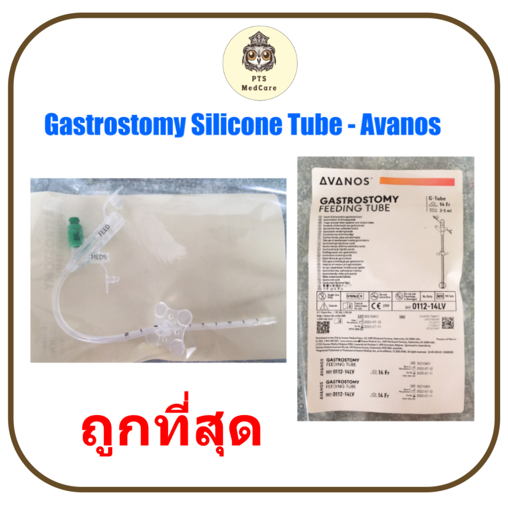 สายให้อาหารทางหน้าท้อง Gastrostomy Silicone Tube (PEG Tube) - Avanos