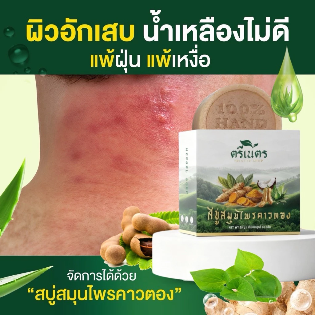 สบู่สมุนไพรคาวตอง ตรีเนตร ลดคัน ผื่น สะเก็ดเงิน ผิวอักเสบ สิว