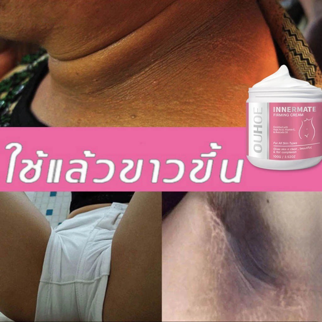 ครีมบำรุงผิวใต้วงแขนให้ขาวกระจ่างใส 100 กรัม ครีมบำรุงผิวขาวนี้เหมาะสำหรับผิวหมองคล้ำบริเวณสะโพก ใต้วงแขน ต้นขาด้านใน หล