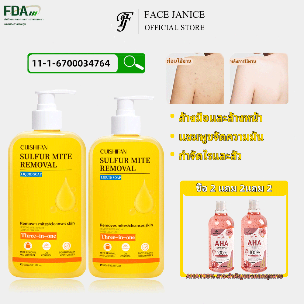 【ซื้อ 2 แถม 2】  สบู่อาบน้ำ 3-อิน-1 อัพเกรดสูตร สบู่ซัลเฟอร์ 100% แอนตี้แบคทีเรีย กำจัดสิว ทำความสะอาดล้ำลึก 300มล.