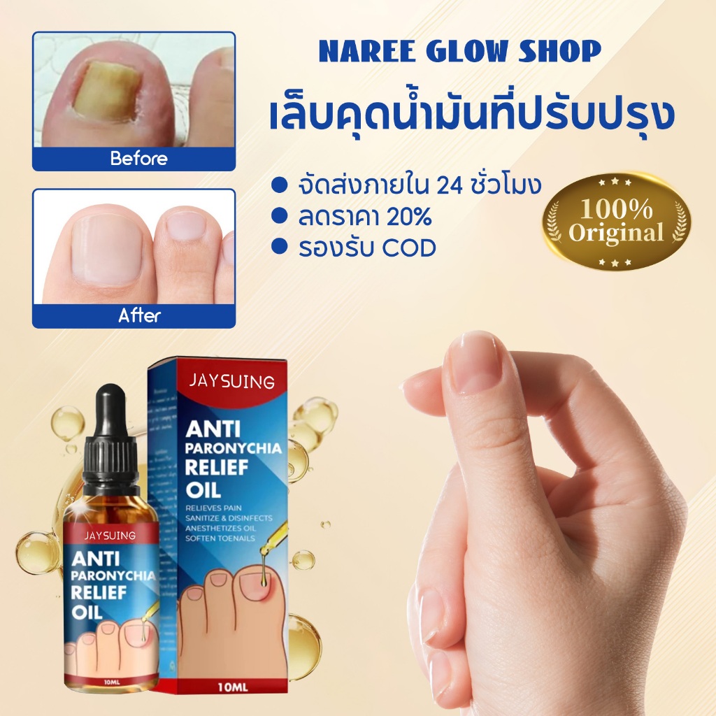 Jaysuing น้ํายาปรับเล็บขบ เล็บ ขบ รักษา เล็บขบ ปรับเล็บขบ โรคติดเชื้อที่ขอบเล็บ เล็บแตก ซ่อมแซมเล็บ รักษาเชื้อราที่เล็บ