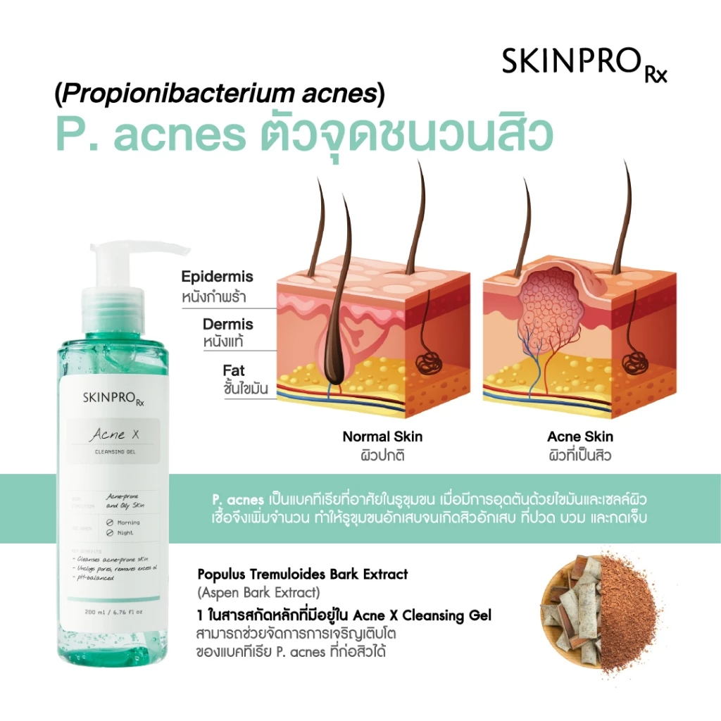 SKINPRO Rx Acne X Cleansing Gel คลีนซิ่งเจลสูตรสำหรับผิวมัน/เป็นสิว ลดการเกิดสิว ไซส์ใหญ่ 200ml. thumbnail 7