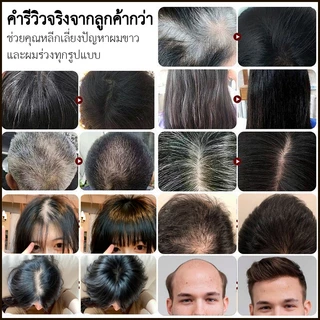 ของแท้100%✅SAFEMILDชุดซักและดูแล! แชมพูดูอัลแคร์+ครีมนวดผม แชมพูปิดผมขาว อกและลดการหลุดร่วงของเส้นผม
