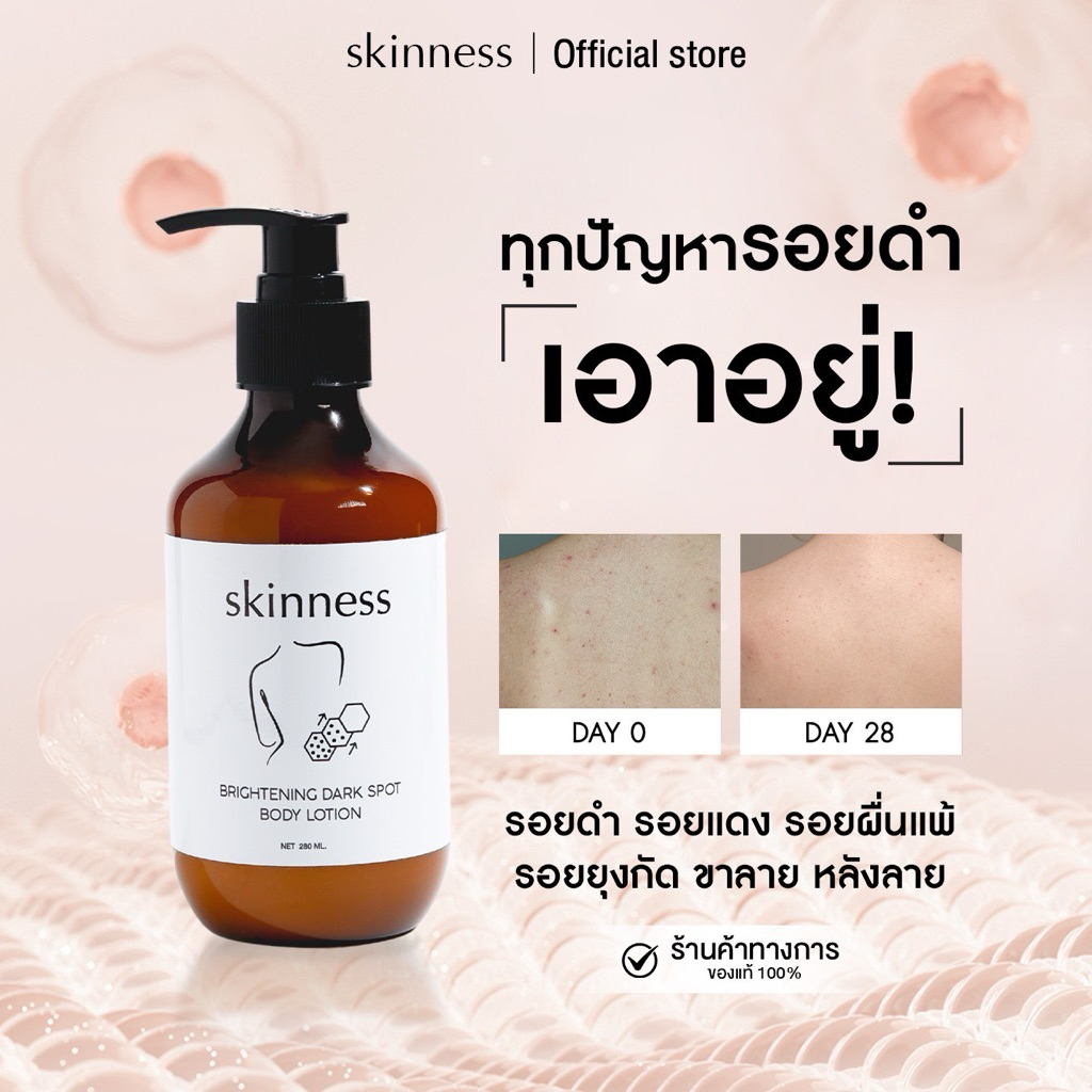 [พร้อมส่งทุกวัน] skinness brightening dark spot body lotion | ครีมลดรอยผิวกายฝาดำ