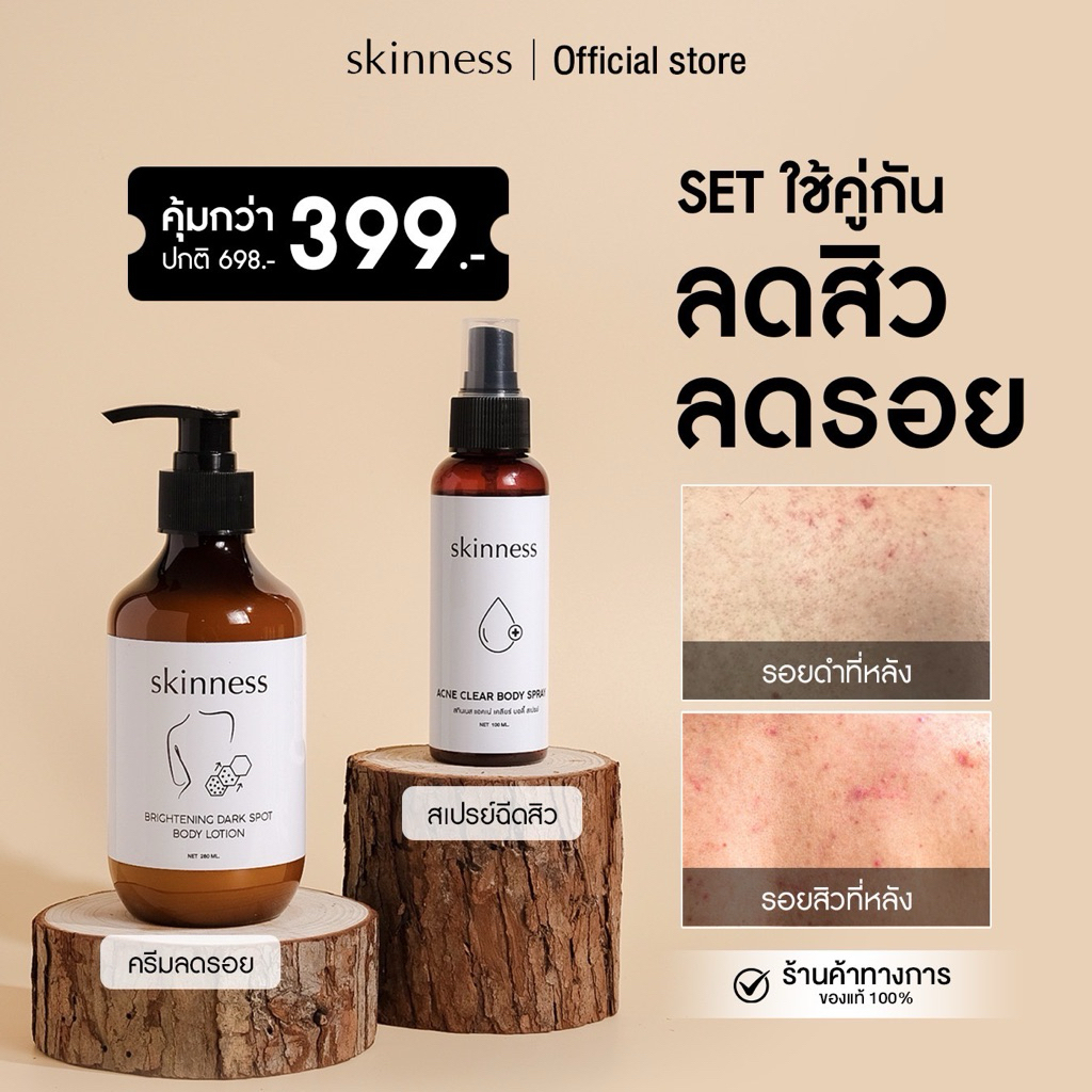 SET คู่สุดคุ้ม [ลดสิว+ลดรอย] brightening dark spot body lotion + acne  body spray | สำหรับผิวกาย (สเปรย์และครีม)