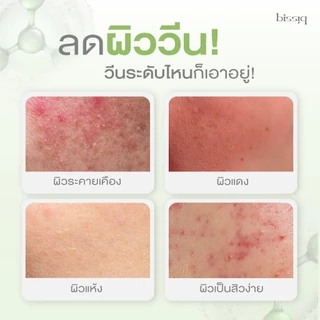 [ซื้อ 1แถม1] bissiq Moisturizer I เจลต้านผิววีน สำหรับผิวมัน เป็นสิว และ พุดดิ้งมอยส์ สำหรับผิวแห้ง