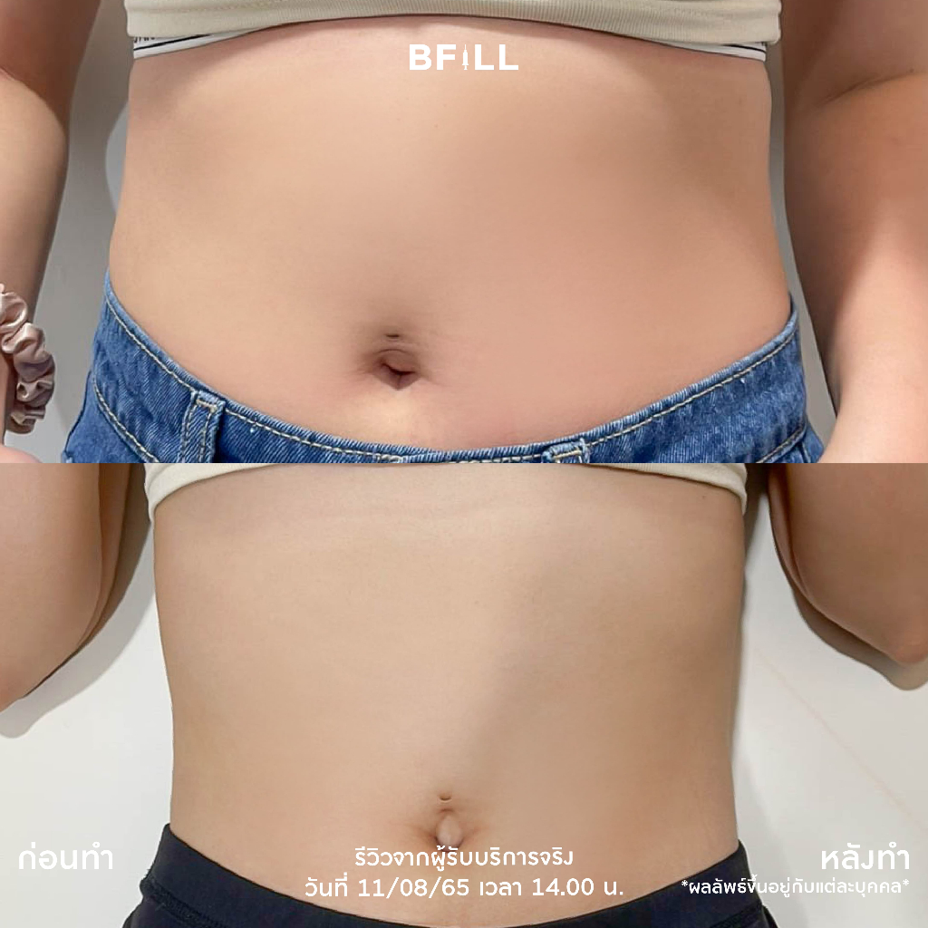 รูปภาพ 5