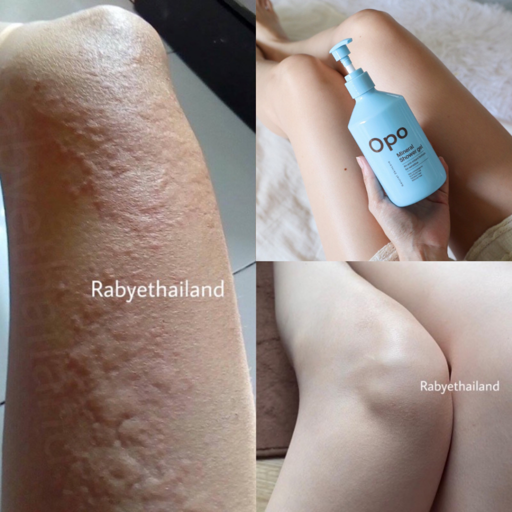 OPO | Rabye Mineral​ Shower สบู่เหลวน้ำแร่ ลดผดผื่นคัน​ ผิวอักเสบแดง แพ้ง่าย​ น้ำเหลืองไม่ดี ราคา ถูกที่สุด ดีลบีเคเค แกลเลอรีภาพที่ 6