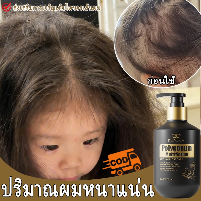 แชมพูแก้ผมร่วง แชมพูโสมเหอโช่วอู แชมพูปลูกผม 500ml ป้องกันหัวล้าน ขจัดรังแค เพิ่มวอลลุ่ม บํารุงรากผม ลดผมร่วง เร่งผมยาว